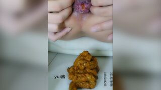Chinese girl spread asshole scat, ScatKings.com Scat Porn 7 ScatKings.com Scat Porn